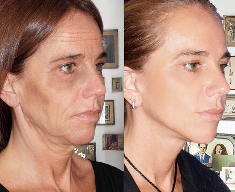 BEAUTCRET Antiedad Con Oro 24K